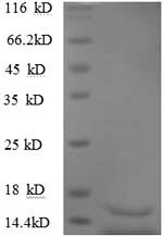 Transforming growth factor beta-3 (TGFB3), partial, human, recombinant