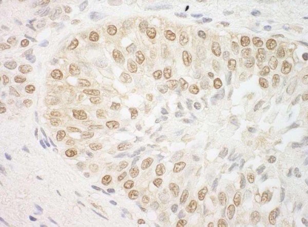 Anti-ARID3B (IHC)