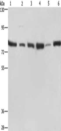 Anti-SIRT1
