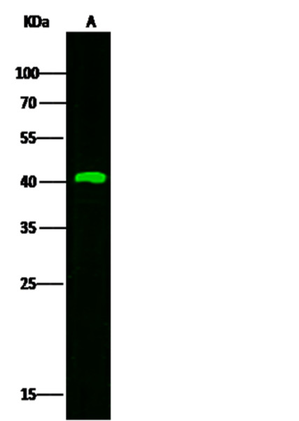 Anti-KLK-11/Kallikrein-11 Monoclonal Recombinant Antibody