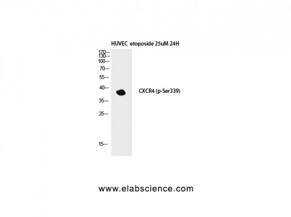 Anti-Phospho-Fusin (Ser339)