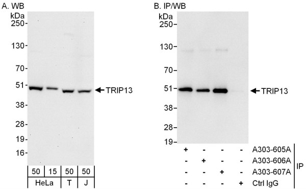 Anti-TRIP13