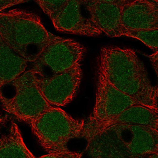 Anti-TFDP3