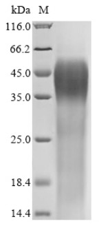 Cation channel sperm-associated protein 1 (CATSPER1), partial, human, recombinant