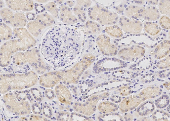 Anti-PHYH Monoclonal Antibody