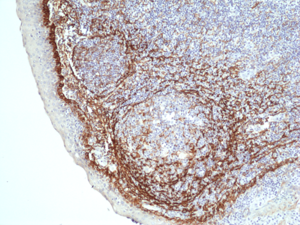 Anti-Podoplanin (gp36), Rabbit Monoclonal (RM449)