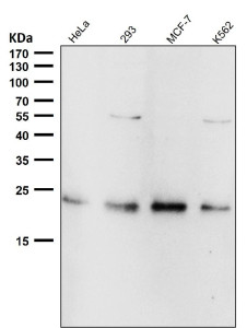 Anti-RAB22A / Ras related protein Rab-22A, clone 31R51
