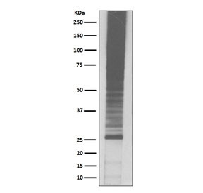 Anti-Ubiquitin / K48-Linkage Specific, clone IBH-21