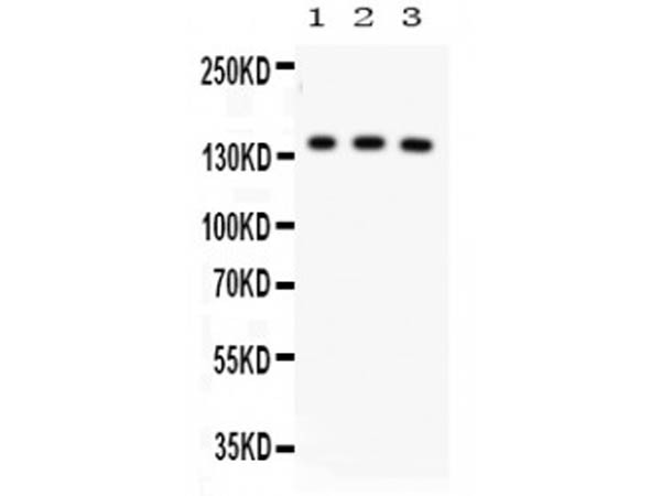 Anti-ABCB11