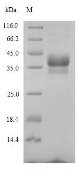 Anthrax toxin receptor 1 (Antxr1), partial, mouse, recombinant