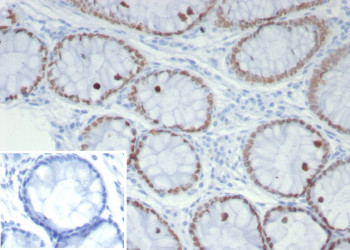 Anti-SATB2 / Special AT-rich sequence-binding protein 2, clone SATB2/7489