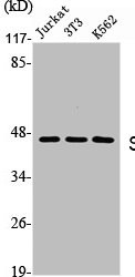 Anti-SKP2