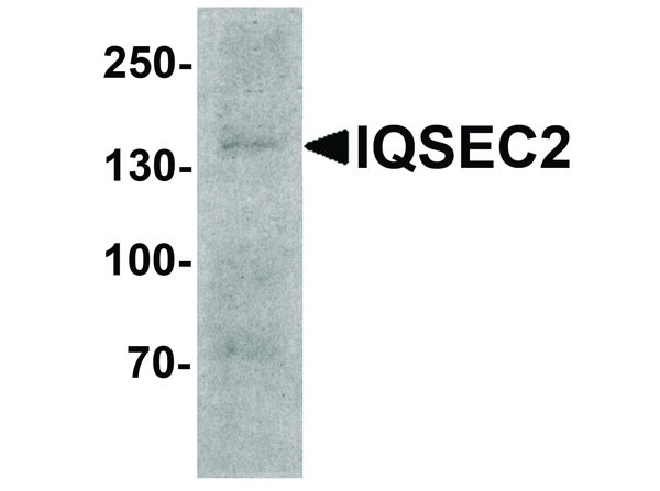 Anti-IQSEC2