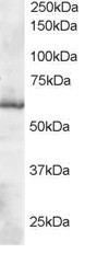 Anti-Thioredoxin Reductase 1, C-terminal