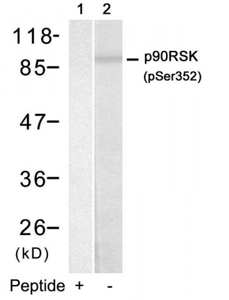 Anti-phospho-p90 RSK (Ser352)