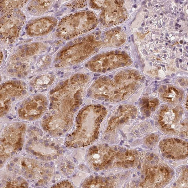 Anti-RNASE7