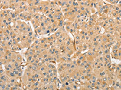 Anti-ATG3