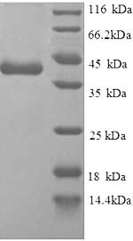Replication protein A 14KDA subunit (RPA3), partial, human, recombinant