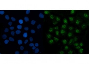 Anti-TMED5 / Transmembrane emp24 domain-containing protein 5
