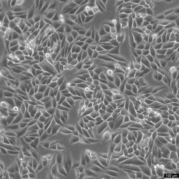 SiHa Cells