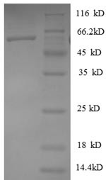 Heterogeneous nuclear ribonucleoprotein D0 (HNRNPD), partial, human, recombinant