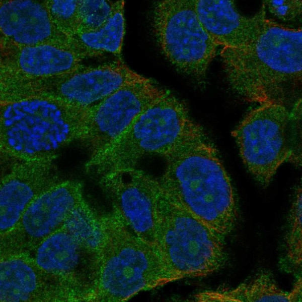 Anti-CEMIP2