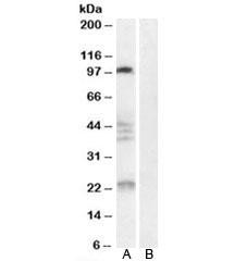 Anti-Nogo 66 receptor