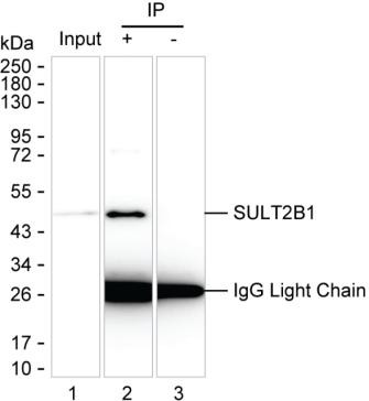 Anti-SULT2B1