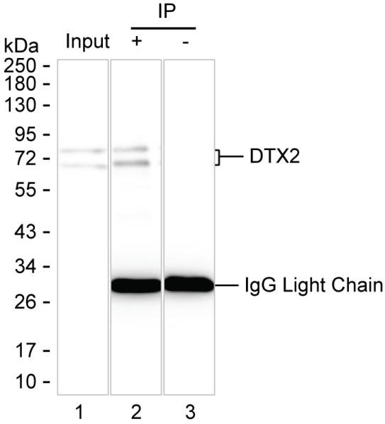 Anti-DTX2 Magnetic Beads