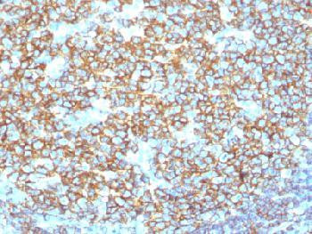 Anti-CD20 / MS4A1 (B-Cell Marker) (clone: IGEL/1497R) (recombinant rabbit monoclonal)