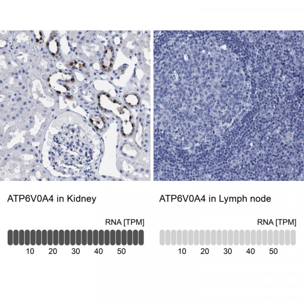 Anti-ATP6V0A4