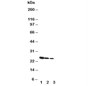 Anti-Growth Hormone (Rat)