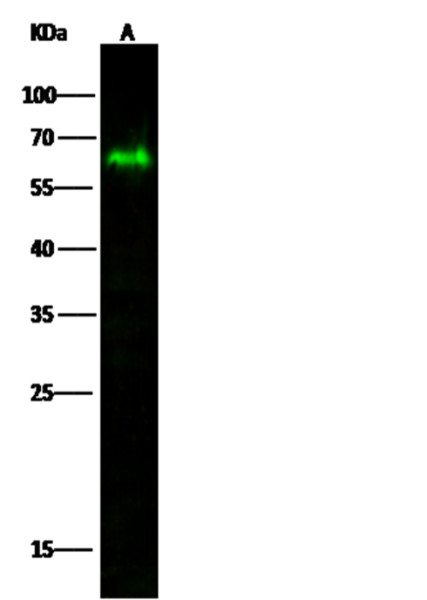 Anti-MICB Monoclonal Recombinant Antibody
