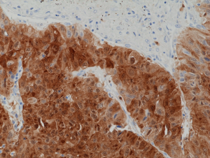 Anti-Arginase-1 (human), Rabbit Monoclonal (RM377)