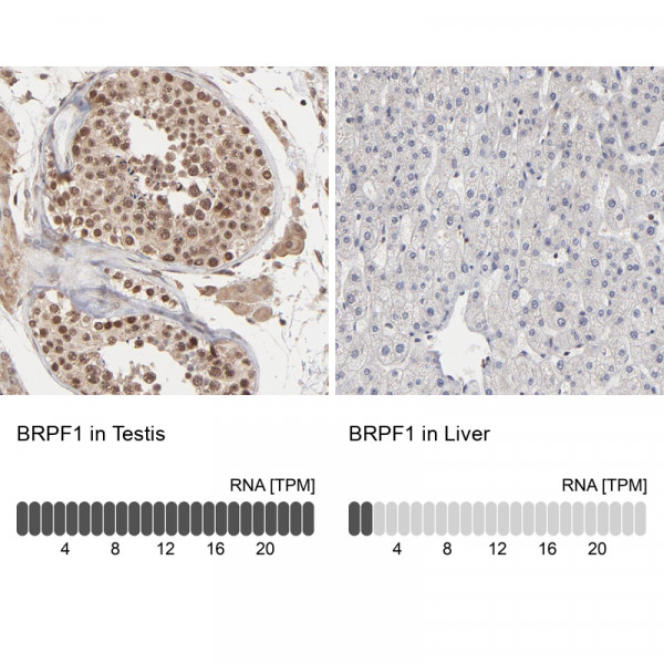 Anti-BRPF1