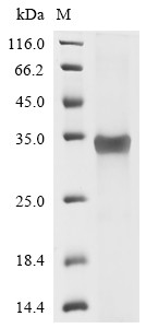 Zinc finger protein GLI1 (GLI1), partial, human, recombinant