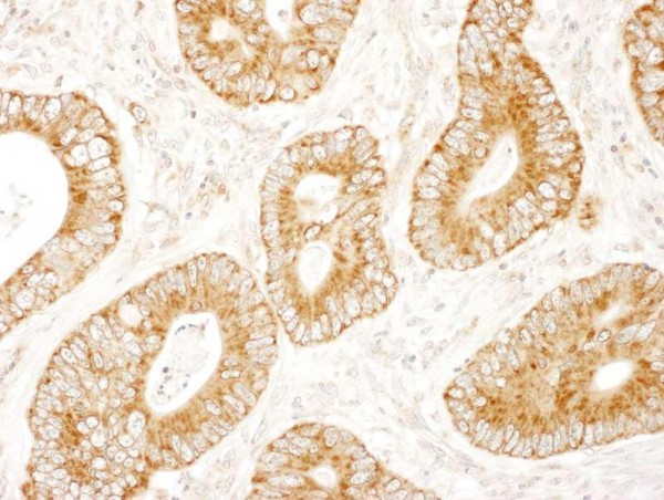 Anti-MADD (IHC)