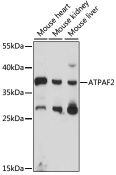 Anti-ATPAF2