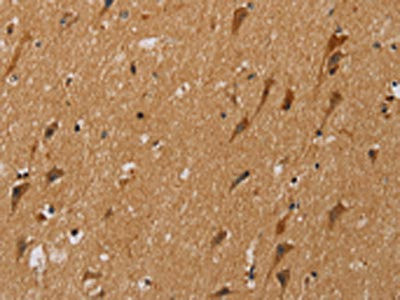 Anti-NDUFS5