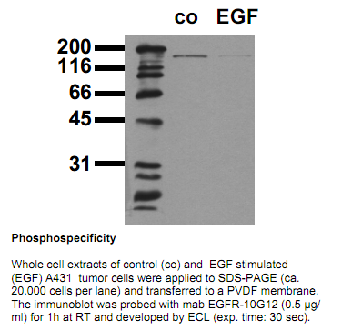 Anti-non-phospho-EGF Receptor (dephosphorylated Tyr1173), clone 20G3