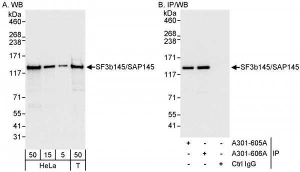 Anti-SF3b145/SAP145