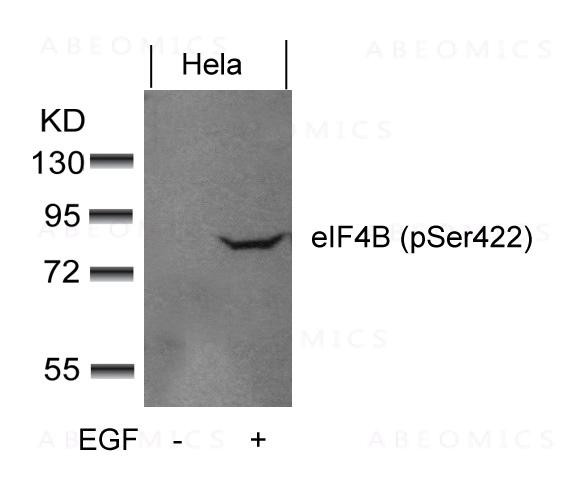 Anti-eIF4B (phospho-Ser422)