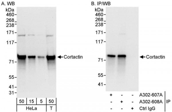 Anti-Cortactin