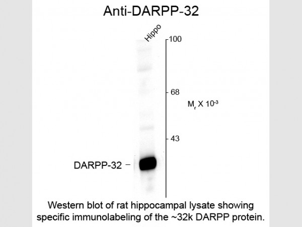 Anti-DARPP-32