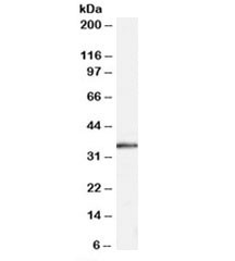 Anti-STUB1