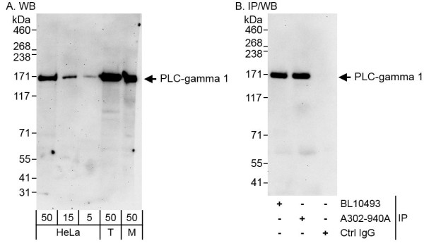 Anti-PLC-gamma 1