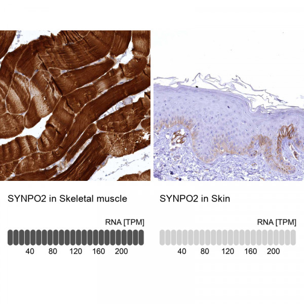 Anti-SYNPO2