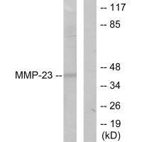 Anti-DCTN2