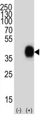 Anti-CD38