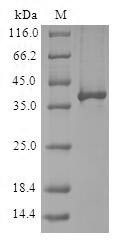 E3 ubiquitin-protein ligase RBX1 (RBX1), human, recombinant